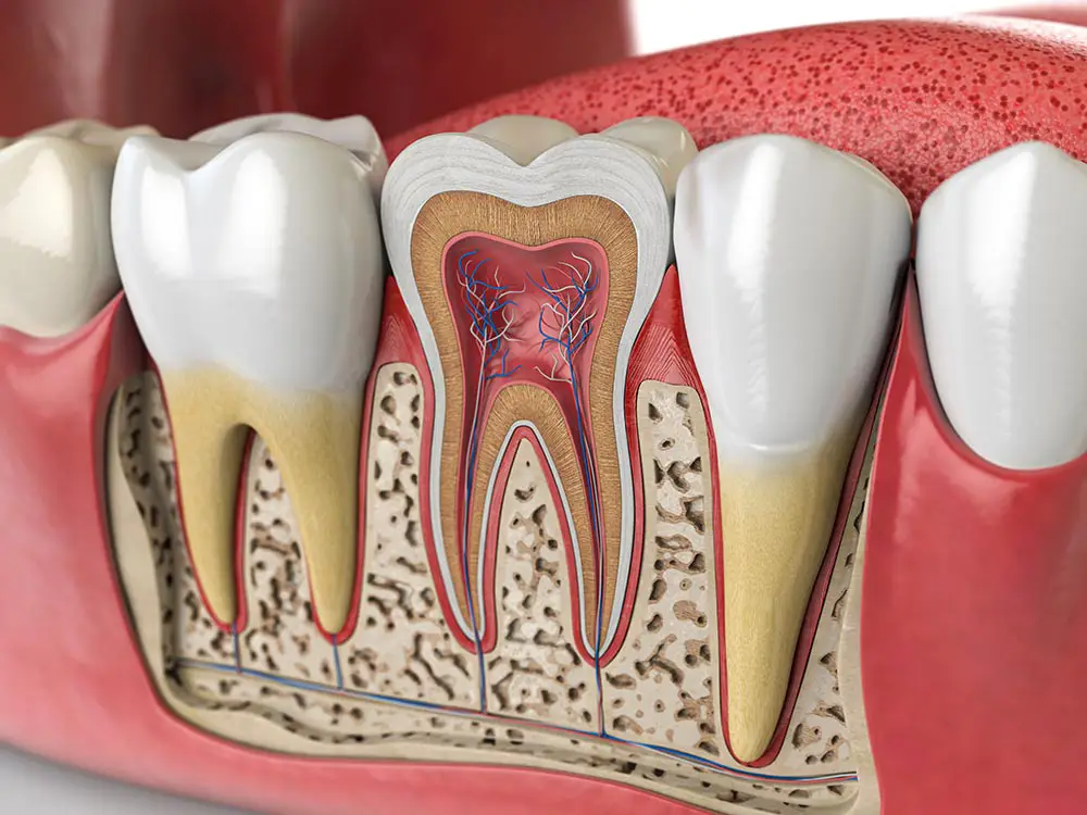 What is root canal - Root Canal in Sacramento - Ideal Dentistry
